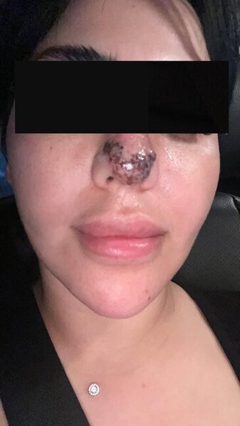 Rəna Soltanovanın daha bir qurbanı danışdı: "İşimdən oldum, külli miqdarda pul itirdim"