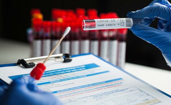 Bu günə olan yoluxma sayı AÇIQLANDI