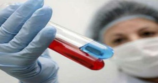 "Donuz qripi", yoxsa soyuqdəymə - Necə seçə bilməli ?