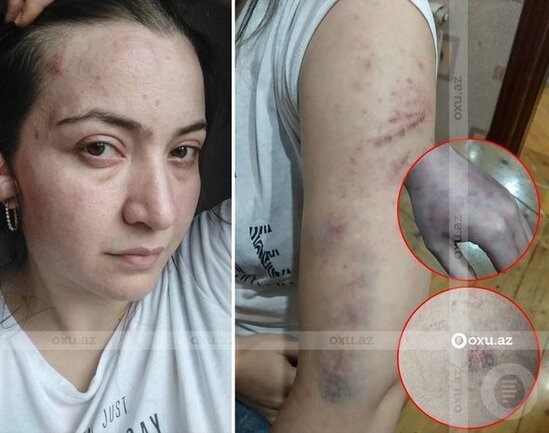 Polis şöbəsindəki qətllə bağlı yeni açıqlama: "Təhqiqatçı olmasaydı bizi də güllələyərdi" - AUDİO