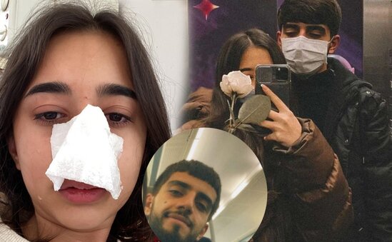 Sevgilisi azərbaycanlı blogeri döyüb - Fotolar