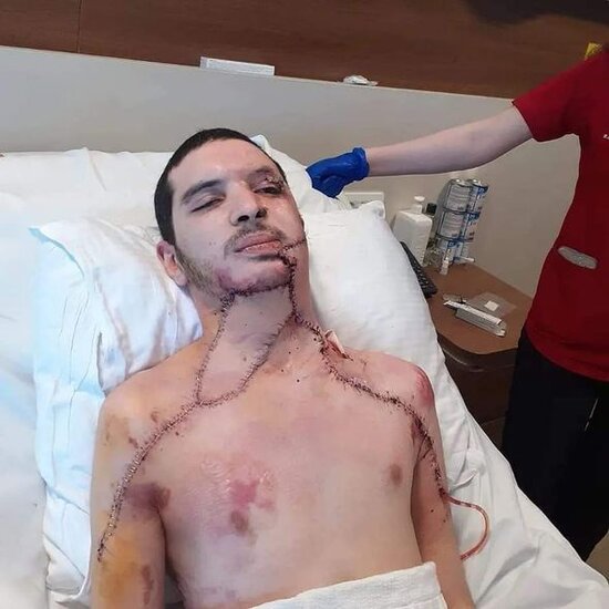 Ağır durumda olan qazi ilə bağlı RƏSMİ AÇIQLAMA