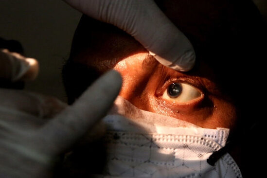 Təhlükəli xəstəliyin fəsadları: "Qara kif" nədir və sağlamlığımıza necə təsir edir?