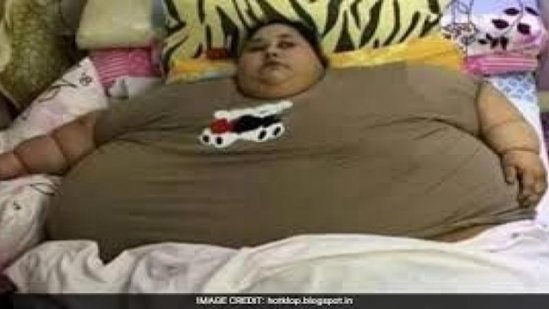 Dünyanın ən kök insanı - 500 kilo çəkisi var - FOTOLAR