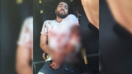 Ermənilərin açdığı atəş nəticəsində "Azercell"in əməkdaşı yaralanıb – FOTO