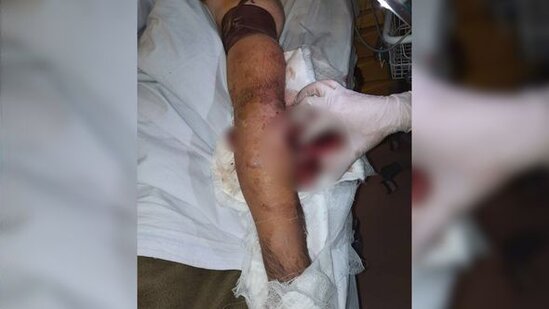 Ermənilərin açdığı atəş nəticəsində "Azercell"in əməkdaşı yaralanıb – FOTO