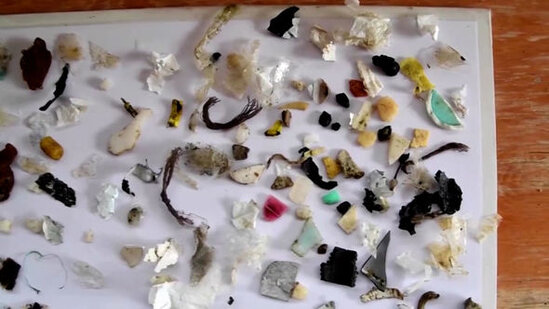 Tısbağanın mədəsindən 10 növ plastik çıxarıldı – FOTO - VİDEO