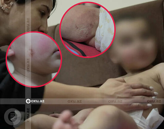 Bakıda anası tərəfindən atılmış iki yaşlı uşaq sığınacağa yerləşdirildi – YENİLƏNİB + FOTO