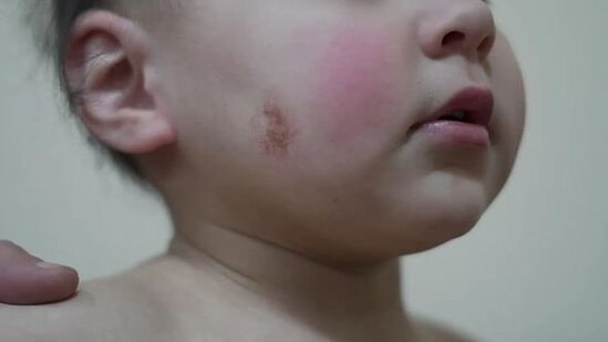 Bakıda anası tərəfindən atılmış iki yaşlı uşaq sığınacağa yerləşdirildi – YENİLƏNİB + FOTO