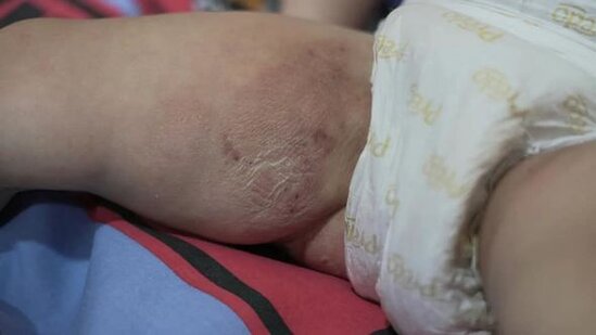 Bakıda anası tərəfindən atılmış iki yaşlı uşaq sığınacağa yerləşdirildi – YENİLƏNİB + FOTO