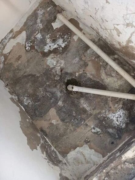 Bakının ən böyük xəstəxanalarından biri xəstəlik yuvasına dönüb - FOTO