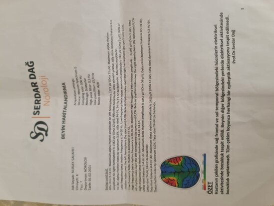 9 yaşlı Nurayın köməyinizə ehtiyacı var - FOTOLAR