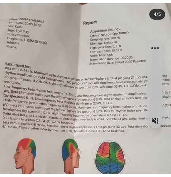 9 yaşlı Nurayın köməyinizə ehtiyacı var - FOTOLAR