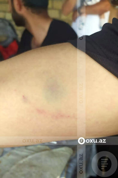 Kişi oğlunun döyüldüyünü, məmur isə söyüldüyünü deyir - İcra və Probasiya Şöbəsində QALMAQAL + FOTO