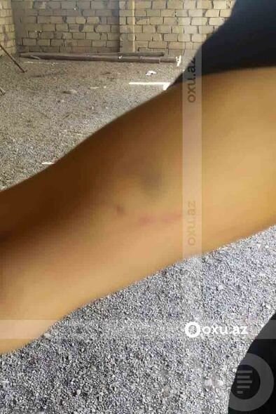 Kişi oğlunun döyüldüyünü, məmur isə söyüldüyünü deyir - İcra və Probasiya Şöbəsində QALMAQAL + FOTO