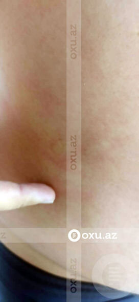 Kişi oğlunun döyüldüyünü, məmur isə söyüldüyünü deyir - İcra və Probasiya Şöbəsində QALMAQAL + FOTO