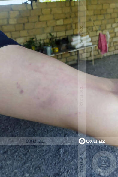 Kişi oğlunun döyüldüyünü, məmur isə söyüldüyünü deyir - İcra və Probasiya Şöbəsində QALMAQAL + FOTO