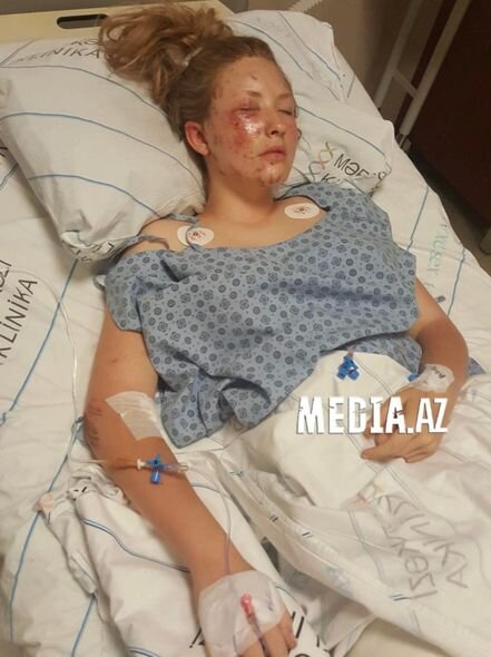 Şamaxıda qəzada xəsarət alan məktəblinin anası: "Zərbə qızımı avtobusun ön şüşəsindən atıb" - FOTO