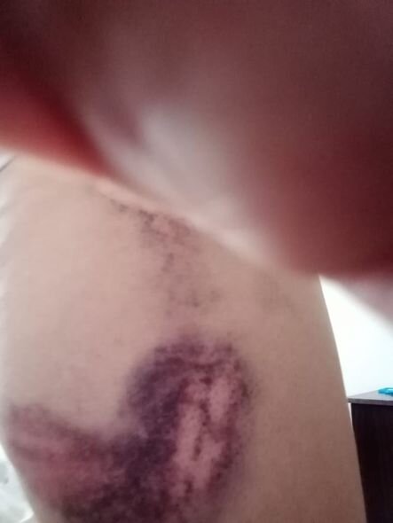 Qaradağda kişinin döyüb evdən qovduğu arvadı əmisi qızı imiş - YENİLƏNİB + FOTO