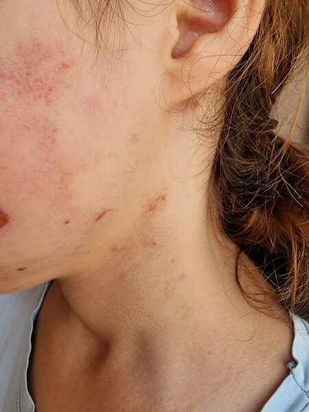 İcra başçısının müavini tərəfindən döyüldüyü iddia olunan qız xəstəxanaya yerləşdirildi – YENİLƏNİB + FOTO