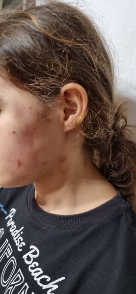 İcra başçısının müavini tərəfindən döyüldüyü iddia olunan qız xəstəxanaya yerləşdirildi – YENİLƏNİB + FOTO