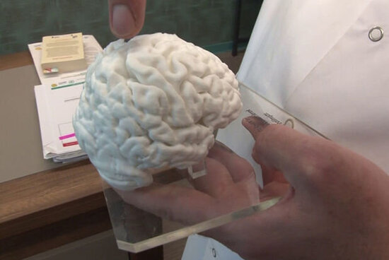 Türkiyədə İLK: 3D printerlə insan beyninin nüsxəsi hazırlandı - VİDEO