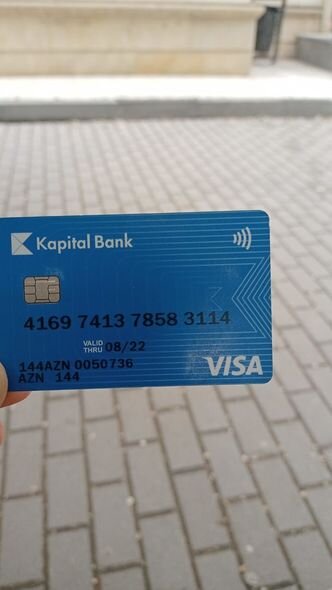 13 yaşlı Emil leykozdan əziyyət çəkir - FOTO