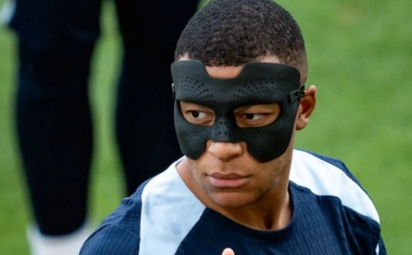 Burnu sınan Mbappe üçün xüsusi maska hazırlandı