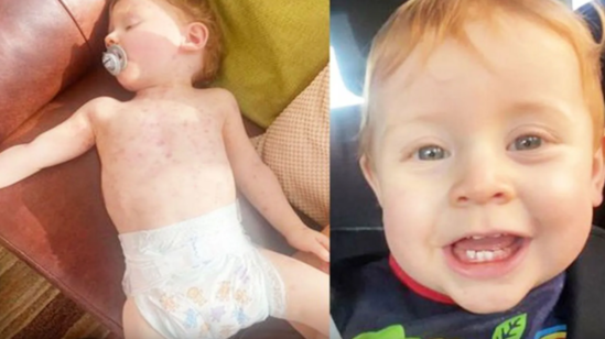 17 aylıq bu uşağın barmaqları kəsilə bilər - FOTO