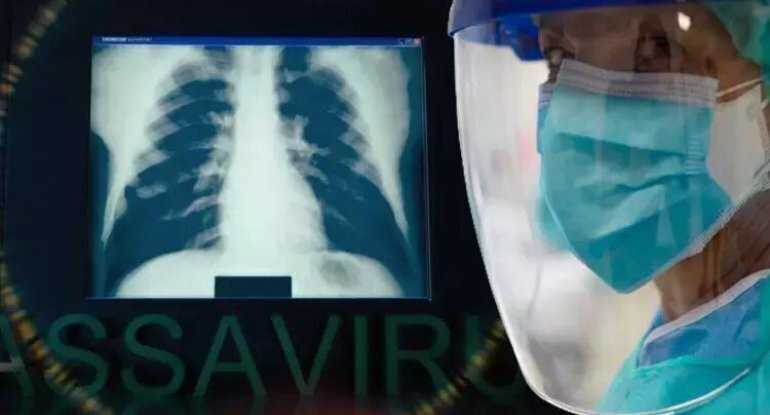 Orqanlarda qanaxmaya səbəb olan virusun məskəni tapıldı