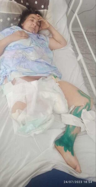 Nərimanov Tibb Mərkəzi xəstəni ölümdən belə xilas etdi - FOTO