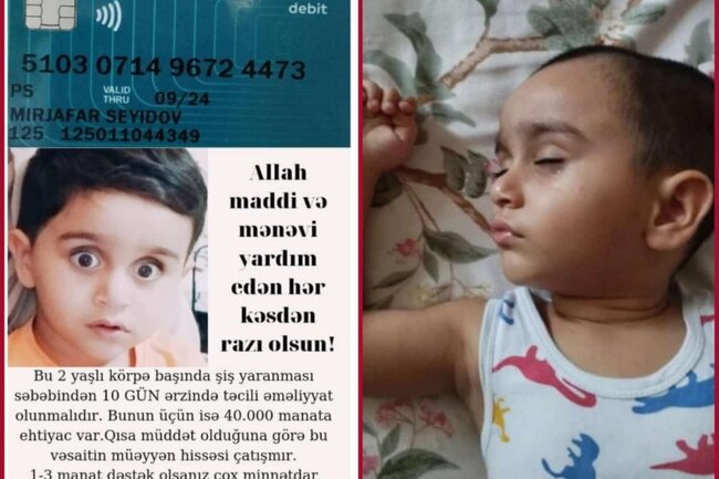 "Mərhəmətli insanlar, yeganə balamı ölməyə qoymayın" - 2 yaşlı Mirsəccadın YARDIMA ehtiyacı var - FOTO/VİDEO