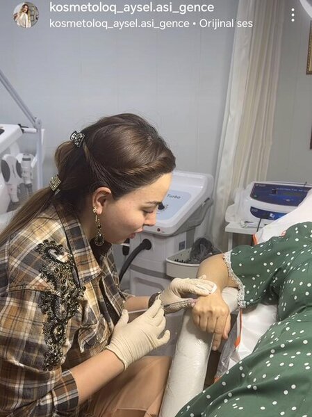 Gəncədə "ixtisaslaşmış kosmetoloq" Aysel Süleymanova tibbi sertifikatı və lisensiyası olmadan necə fəaliyyət göstərir?