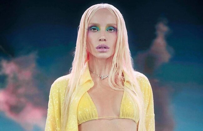 Türkiyəli məşhur müğənni tanınmaz halda - FOTO