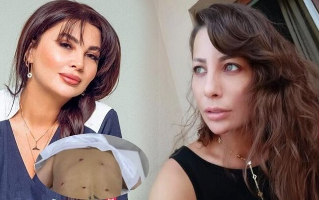 Ülviyyə İlyasovanın cəzası aktrisaya görə artırıldı