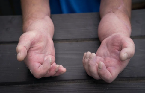 İki əlini də kəsib yenilərini tikdilər - FOTO-VİDEO +18