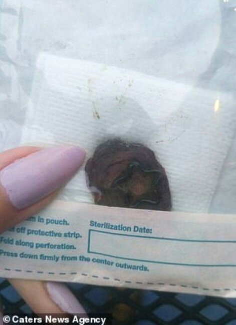 Göbəyini kəsdirib sevgilisinə hədiyyə etdi: Üstünə bu sözləri yazdı - FOTOLAR