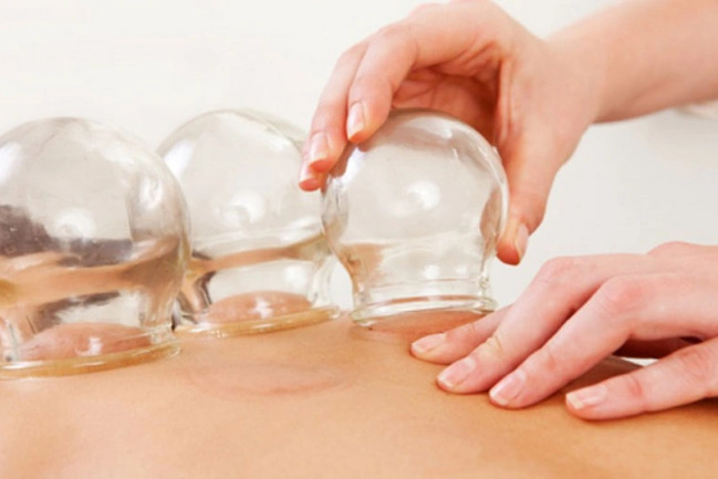 Bakıda belinə banka qoyulan qadın yanıq xəsarətindən ölüb