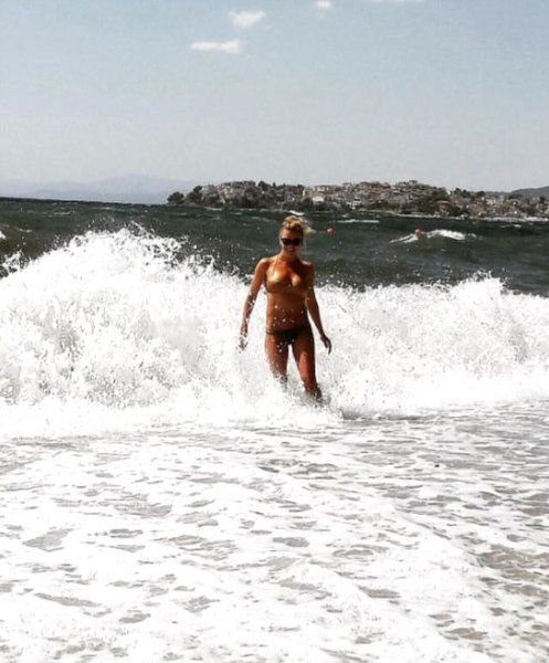 Məşhur aparıcıdan çox üzücü xəbər: silikonları başına görün nə bəla açdı - FOTOLAR