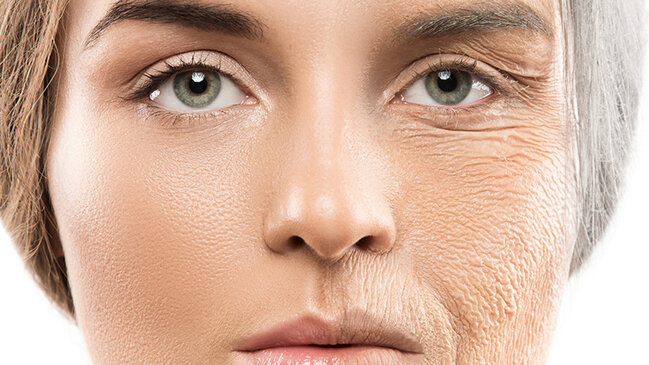 Erkən qırışlara səbəb olan beş vərdiş açıqlandı