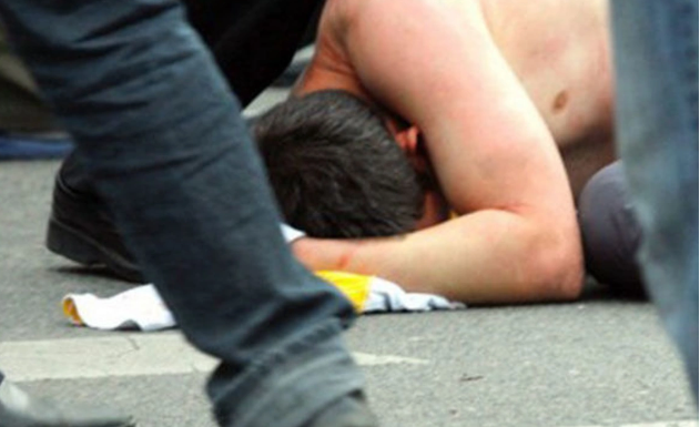 Ağdamda ailə davası: 63 yaşlı kişi oğlu ilə birlikdə qardaşını döydü