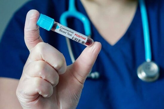 Şimali Kiprdə koronavirusdan ilk ölüm halı qeydə ALINDI