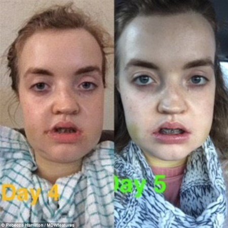 Hər kəs onu lağa qoyurdu, indiki halını görənlər şokda - FOTOLAR