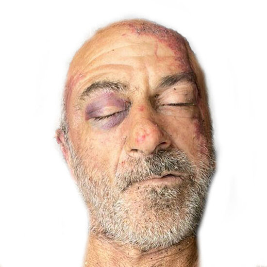 Novxanıda qətlə yetirilmiş şəxsin yaxınları axtarılır - FOTO