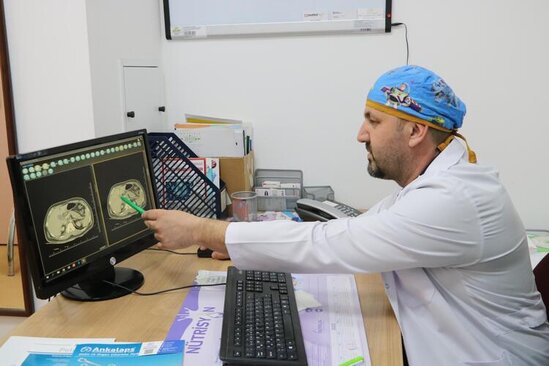 Öd kisəsindən 1250 daş çıxdı, həkim görün nə etdi - FOTO