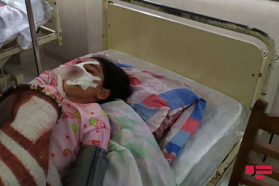 Tovuzda 10-dan çox şəxsi sahibsiz itlər dişləyib - FOTO