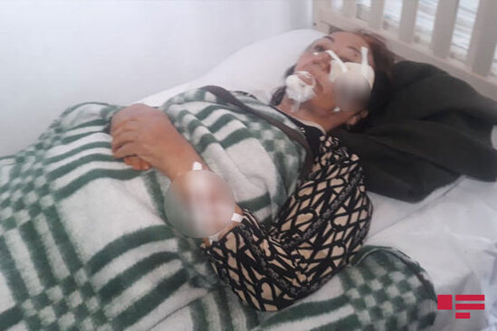 Tovuzda 10-dan çox şəxsi sahibsiz itlər dişləyib - FOTO