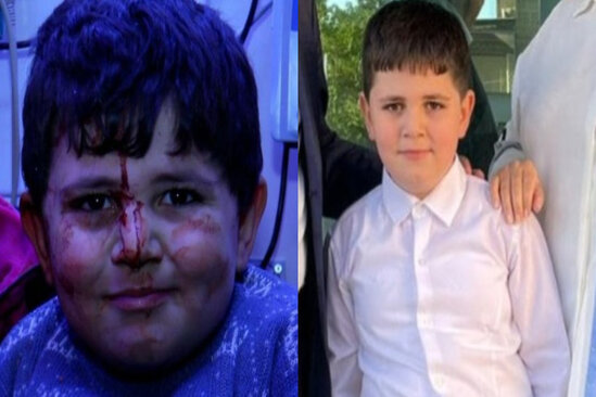 Gəncə terrorunda qan içində gülümsəyən balaca Bəxtiyarın yeni FOTOSU