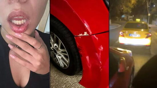 Azərbaycanlı müğənni İstanbulda taksi sürücüsü tərəfindən döyüldü - FOTO/VİDEO