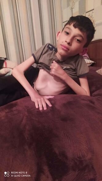 SMA xəstəsi olan bacı-qardaşın sizin köməyinizə ehtiyacı var – FOTO